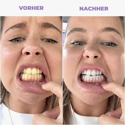 Vorher/Nachher