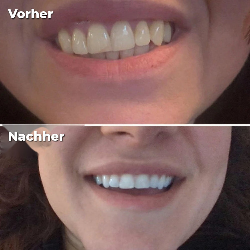 Vorher/Nachher Julien