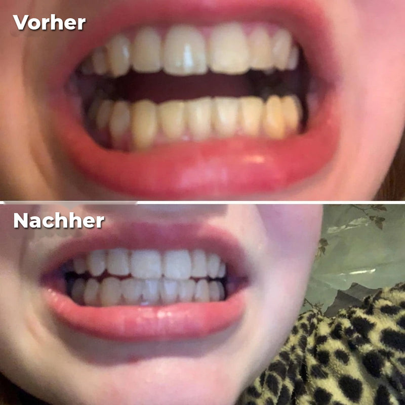 Vorher/Nachher Marion