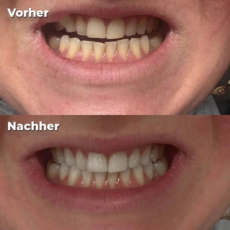 Vorher/Nachher Claire