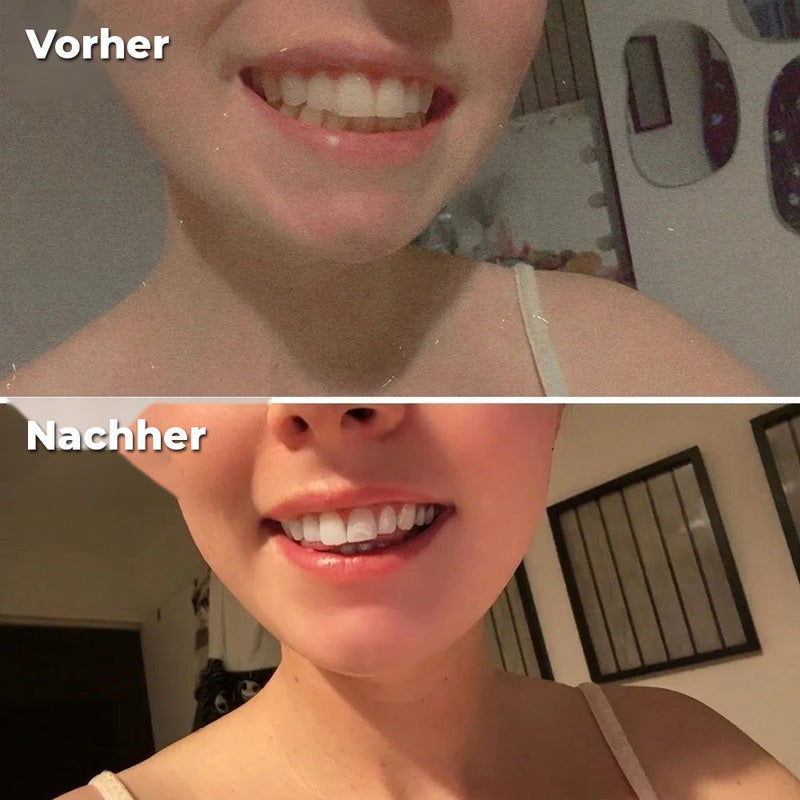 Vorher/Nachher Sophie