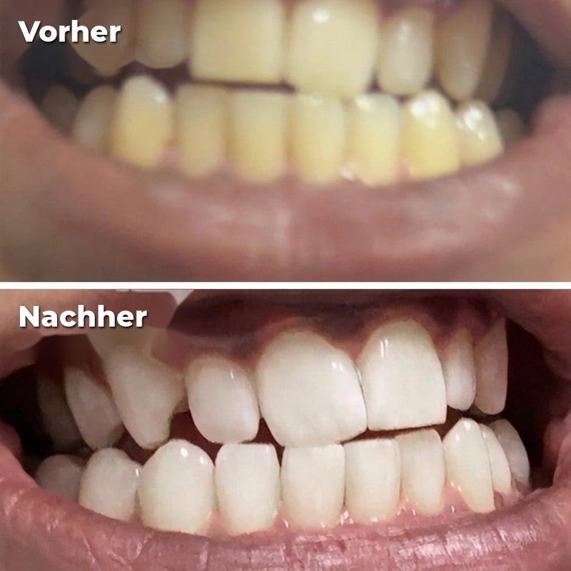 Vorher/Nachher Kévin