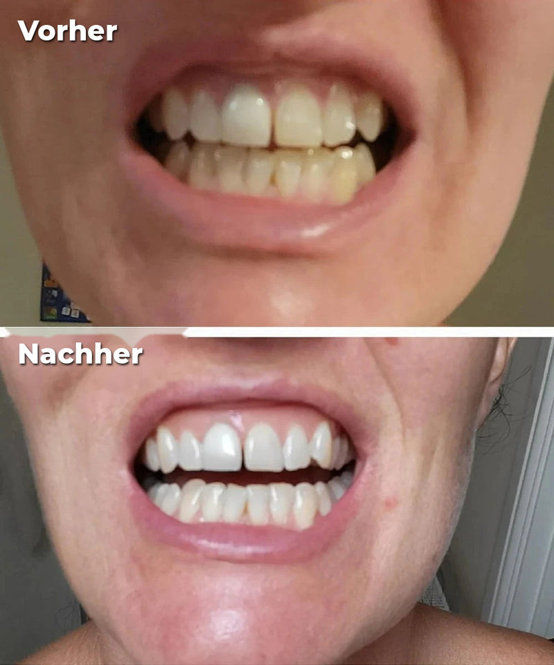 Vorher/Nachher Amandine